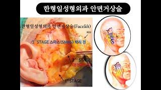 한형일성형외과 안면거상수술 Dual plane Facelift(Extended Deep Plane Facelift) 안면거상수술 후 회복기간 안면거상 수술 방법