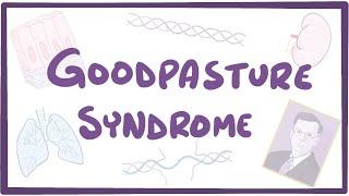 Goodpasture syndrome - causes, symptoms, diagnosis, treatment, pathology