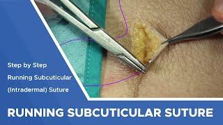 Running Subcuticular (Intracutaneous) Suture: Step by Step Instructions