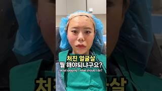 처진얼굴살 고민,실리프팅 시술?