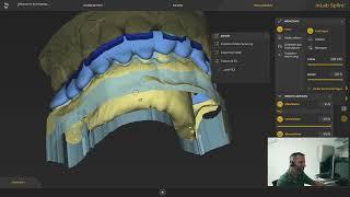 Dentsply Sirona InLab Splint 22 - gefräst McX5 und gedruckt mit Anycubic - so geht´s...