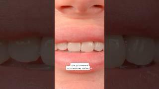 Теперь знаете! #shorts #dentistry #зубнойврач #зубы