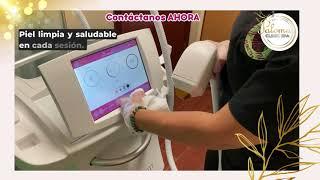 Tratamiento Depilacion laser en Paloma Clinic Spa #belleza #houston #share #spahouston