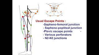 Venous hemodynamics physiopathology and treatments C.Franceschi BARI 2024