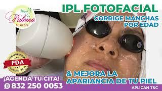 ELIMINA LAS MANCHAS CON FOTOFACIAL IPL