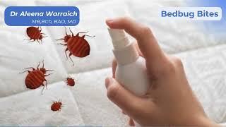 Bedbugs EXPOSED! How to Spot, Kill, and Prevent Infestations"  Produced By Dr Khalid Warraich 