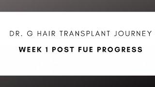 After FUE Hair Transplant - Dr. G Shows One Week Postop (Day 1-7)