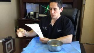 Breast Augmentation with the Keller Funnel