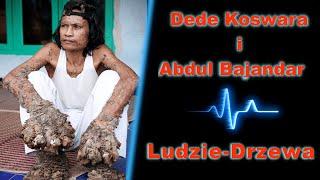 Ludzie-Drzewa: Dede Koswara i Abdul Bajandar