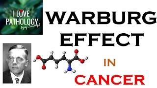 NEOPLASIA 6: WARBURG EFFECT: Hallmark of  CANCER. What, Why & How?