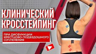 ▶️ CLINICAL CROSS-TAPING FOR SACROILIAC JOINT DYSFUNCTION | Valentin Gait | BBALANCE Training Center