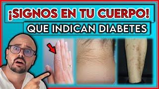 7 SIGNOS VISIBLES en tu CUERPO que indican DIABETES || ¡Así COMIENZA la DIABETES!