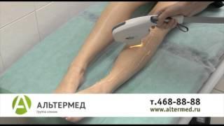 Фотоэпиляция в клинике Альтермед