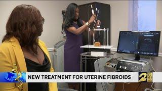 New treatment for uterine fibroids