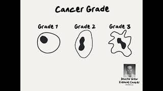 Doctor Explains Cancer Grade