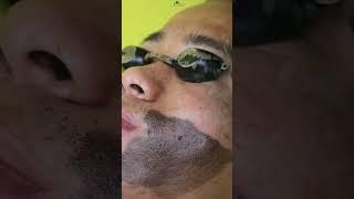 #facial #carbonfacial #cupping #chennai #bangalore #bengaluru #viral #youtube #shorts #trending