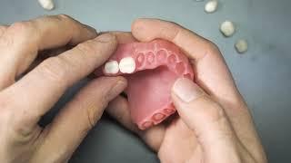 3D Printing Digital Denture with DentaFab 3D Printer and PowerResins Denture resin