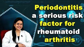 Periodontitis a serious risk factor for rheumatoid arthritis