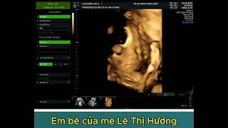 EM BÉ CỦA MẸ LÊ THỊ HƯƠNG - LŨNG HÒA VĨNH TƯỜNG VĨNH PHÚC - THAI 27 TUẦN 4 NGÀY