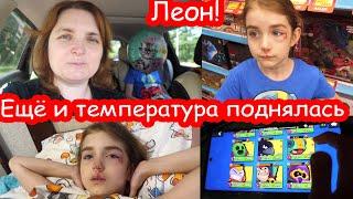 VLOG На второй день лицо сильно опухло