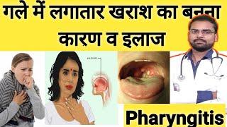 how to curepharnygitisगले में खराश?