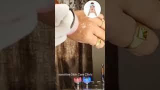 skin Glowing treatment/#skincare #youtubeshorts #youtube #doctor #yt #garnier #clinic #insta