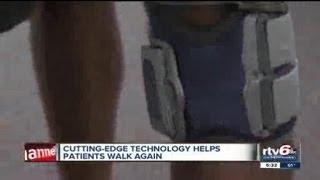 New technology helps once-paralyzed man walk normally again