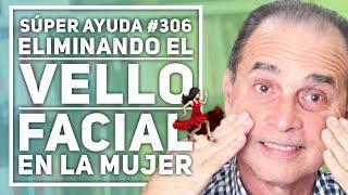 SÚPER AYUDA #306 Eliminando el Vello Facial en la Mujer