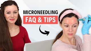 Microneedling FAQ & Must-Know Tips for Amazing Results