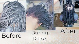 Amazing crazy locs Transformation,  detox +Retwist.  must see