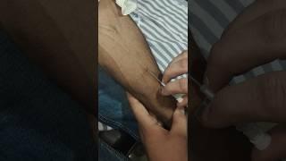 intravenous IV cannulation#nursing #motivation