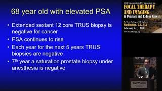 22  Peter Pinto USA   A Negative Fusion Biopsy  What did I miss and what is the next step