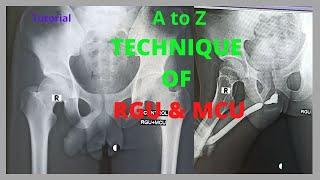 Technique of RGU & MCU (Ep-31) |Retrograde rethrogram and Micturating cystogram | Bangla Tutorial