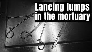 In the mortuary - lancing visible lumps and bumps