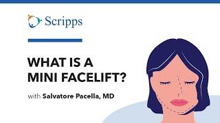 What Is a Mini Facelift with Salvatore Pacella, MD | San Diego Health