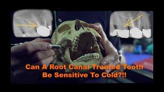 Can a root canal treated tooth be sensitive to cold?