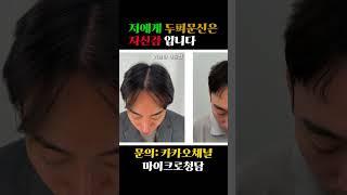 두피문신하고 인생이 바꼈습니다.. #마이크로청담 #두피문신후기