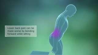 Lumbar Spondylosis Symptoms