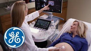 Voluson | GE Healthcare