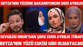 Masterchef Beyza'nın Yüzüne Kızgın Yağ Döküldü Sevgilisi Onur Beyza'yı Terk Etti Yüzüne Bakamıyorum