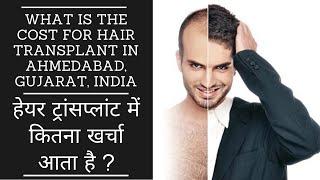 COST OF FUE HAIR TRANSPLANT IN AHMEDABAD, GUJARAT IN HINDI(हेयर ट्रांसप्लांट में कितना खर्चा आता है)