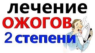 ОЖОГИ 2 степени как ЛЕЧИТЬ, первая помощь!