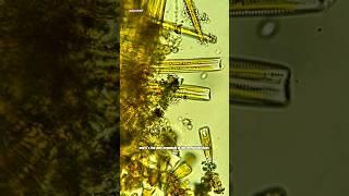 Diatoms Under Microscope (Algae with glass houses)