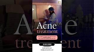 Say goodbye to acne, and hello to clear, confident skin! Ghansoli 8108110896 luxebrowclinic.com