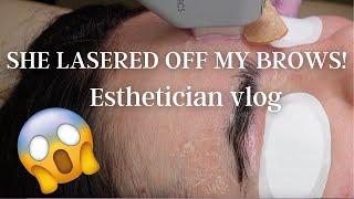 SHE LASERED MY BROWS OFF | Solo Esthetician vlog