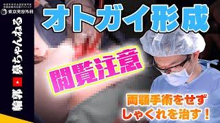 【整形】オトガイ形成を解説します※手術シーンあり【閲覧注意】