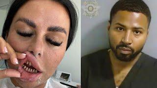 FAKE Veneer Tech Exposed: Atlanta's Biggest TikTok Dentist Arrested! #veneertech #atlanta