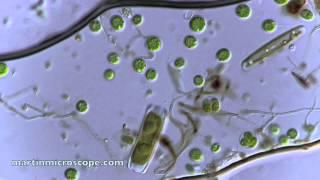 Pond Scum Under the Microscope