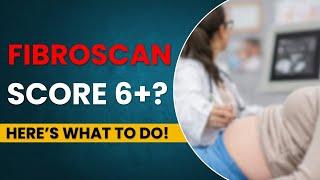 Watch this BEFORE You Get a Fibroscan (Liver Scan) | liver cirrhosis