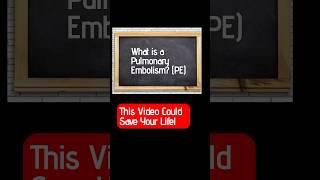 What is a Pulmonary Embolism? This Video Could Save Your Life! #pulmonaryembolism #bloodclot